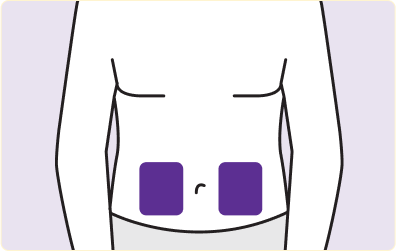 During DARZALEX FASPRO® treatment, a healthcare provider will determine where to inject and prepare the chosen area